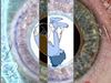 Constellation EYE - TESTAROJA 